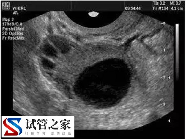 深圳冻卵医院有哪些(图2)