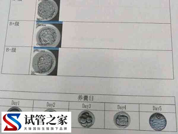 5AC囊胚PGS筛查影不影响质量(图2)