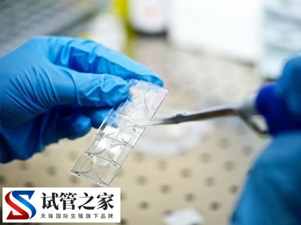 取卵不打麻药和造影哪个疼