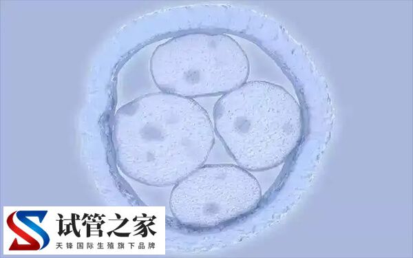 高龄做试管婴儿怎样合理备孕