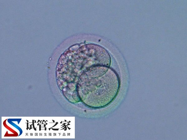 鲜胚与囊胚有什么不同