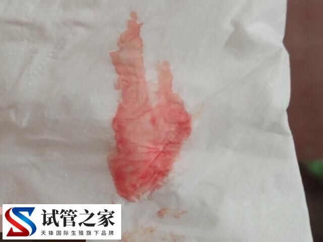 试管婴儿移植后出血的情况分析，手术刺激或为主要原因(图1)