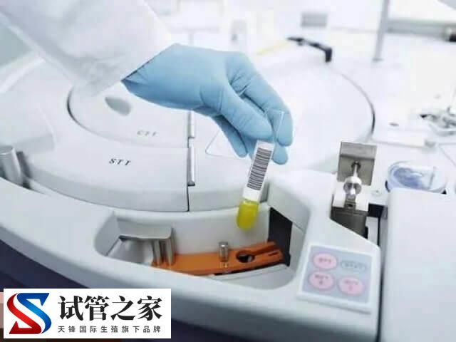 一文告知试管婴儿适用于哪些人，排卵障碍、免疫不孕快瞧(图2)