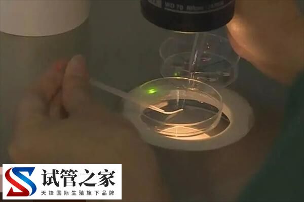 做试管婴儿一般取卵几个合适看完知，有的取10-15个算正常(图2)