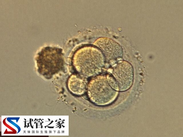 试管婴儿移植哪种胚胎好说不准，对比其着床率一目了然(图2)