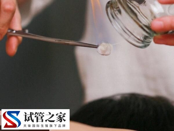 做试管为什么还要求减肥赶紧看,避免影响精卵质量是其一(图2) 做试管为什么还要求减肥赶紧看,避免影响精卵质量是其一(图2)