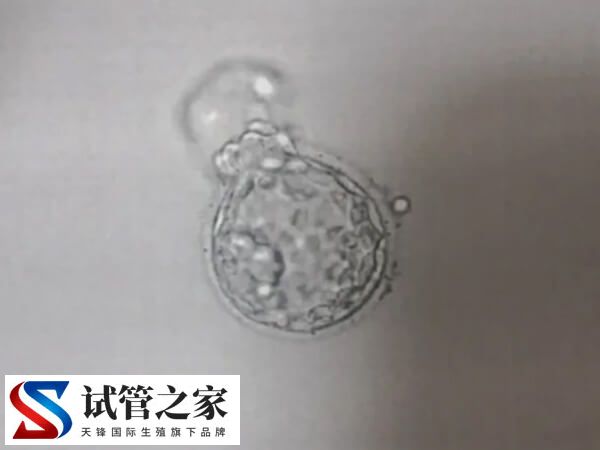 鲜胚移植成功率90%是不是真的