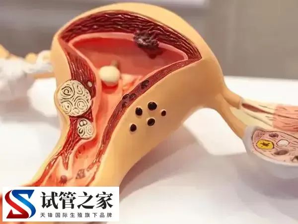 优质囊胚为什么会晚着床