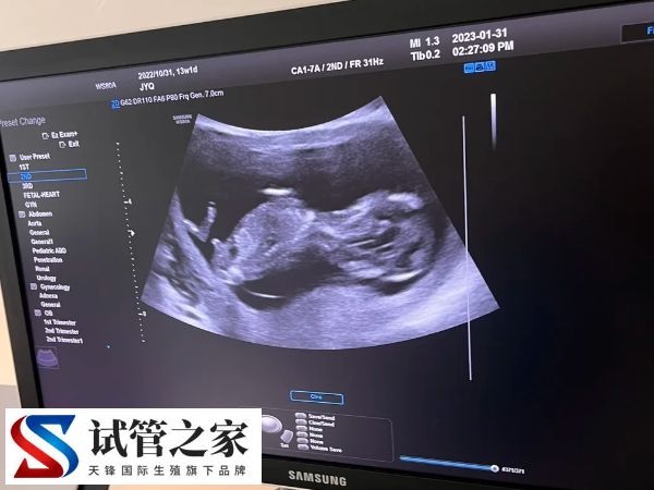 冻囊胚什么时候移植好