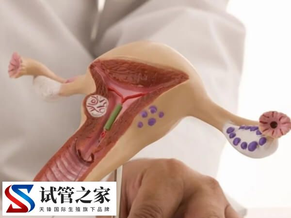 盆腔结核做试管能否成功