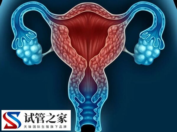 试管婴儿要不要检查弓形虫(图2)