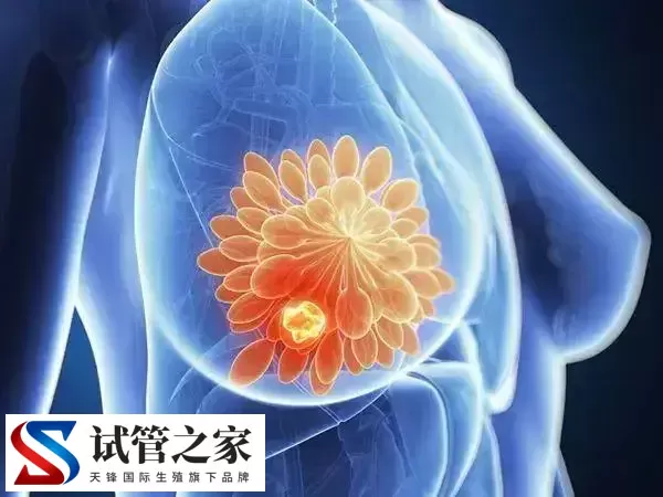 乳腺低回声影不影响试管