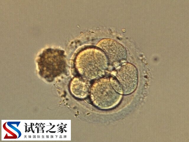 养囊6天了还没结果是好事还是坏事