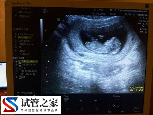 促排卵期间雌二醇600多却取了3个卵泡是怎么回事？(图2)