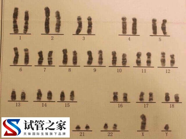 5号染色体三体是什么意思