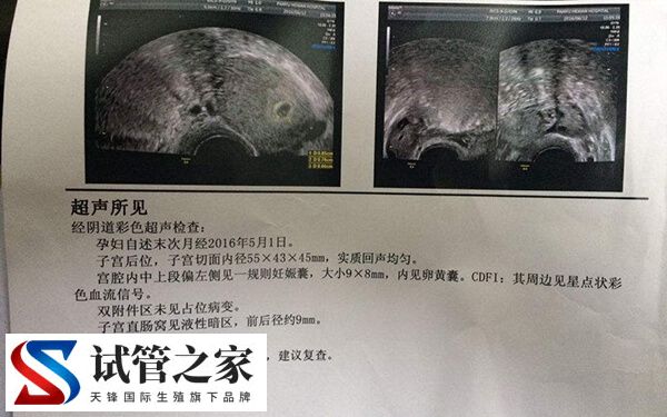 女性长期月经不调在备孕前要做什么身体检查呢？(图2)