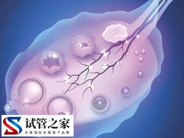 高龄女性去俄罗斯做试管婴儿要怎么做(图1) 高龄女性去俄罗斯做试管婴儿要怎么做(图1)