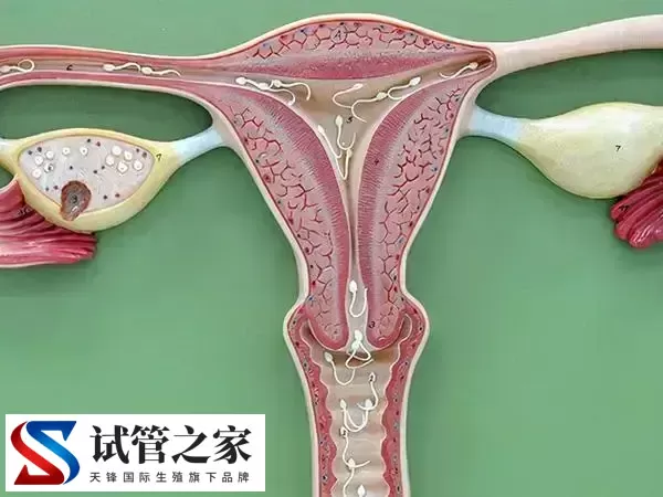 宫颈肥大做试管婴儿会不会影响着床(图3)
