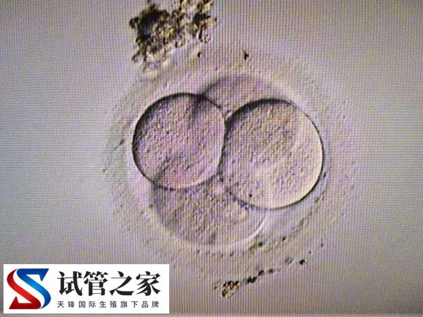 更年期做试管婴儿要怎么调理