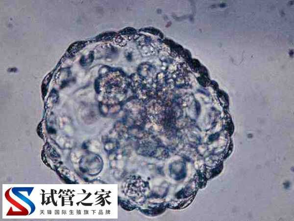 热敷腹部会不会烫死精子和卵子(图2) 热敷腹部会不会烫死精子和卵子(图2)