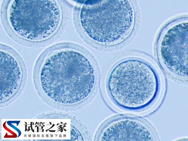 什么原因造成一卵多精(图2)