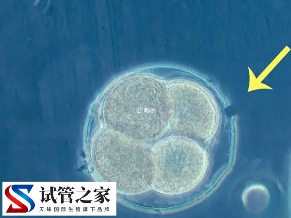 什么叫人体胚胎孵化项目