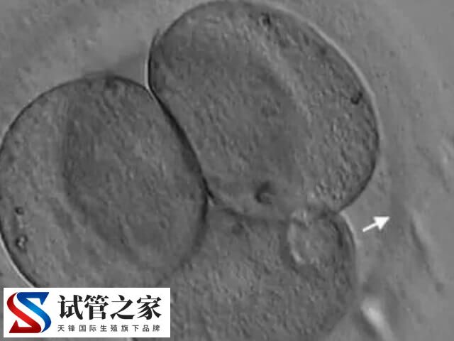 什么叫人体胚胎孵化项目(图2)