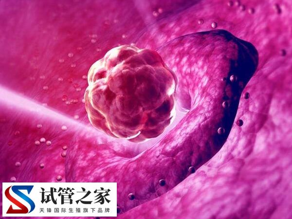 试管移植第17天出血的原因有几种(图2)
