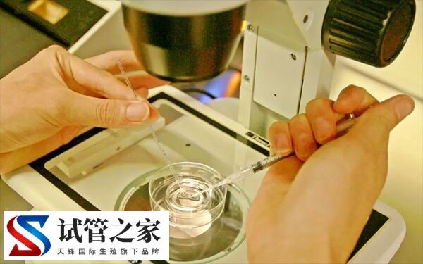 试管卵泡28了才打夜针正不正常(图2) 试管卵泡28了才打夜针正不正常(图2)