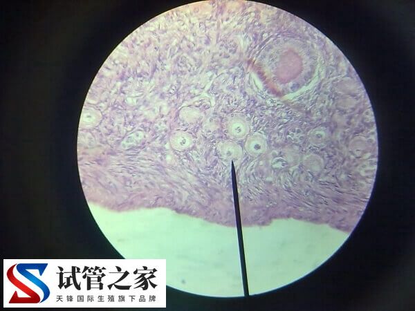 绒促性素是什么药(图3)