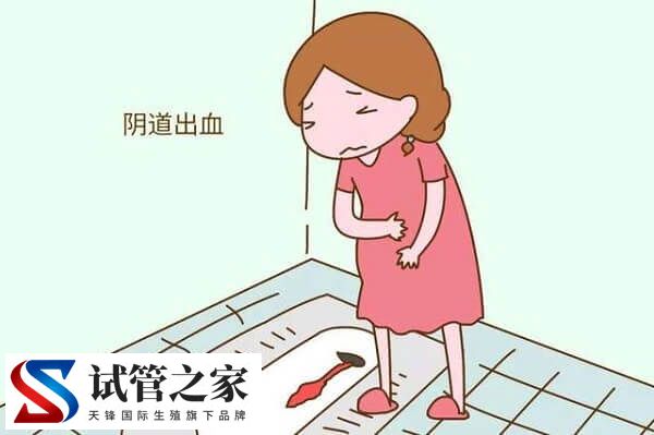 促排用普丽康和果纳芬哪个效果好(图3)