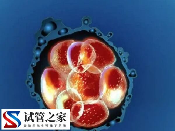 试管婴儿产生心脏畸形是怎么回事(图2)