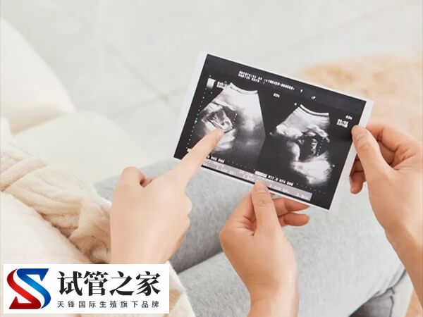 三代试管婴儿囊胚移植宫外孕多久能确诊查出来？