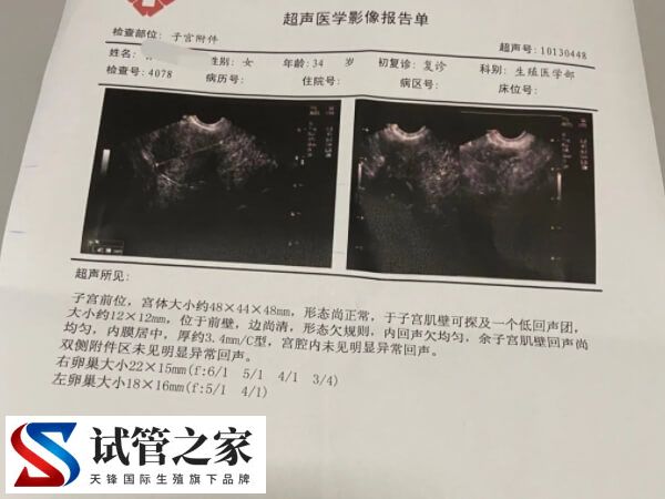 amh检查正常但是窦卵泡数量少是怎么回事？