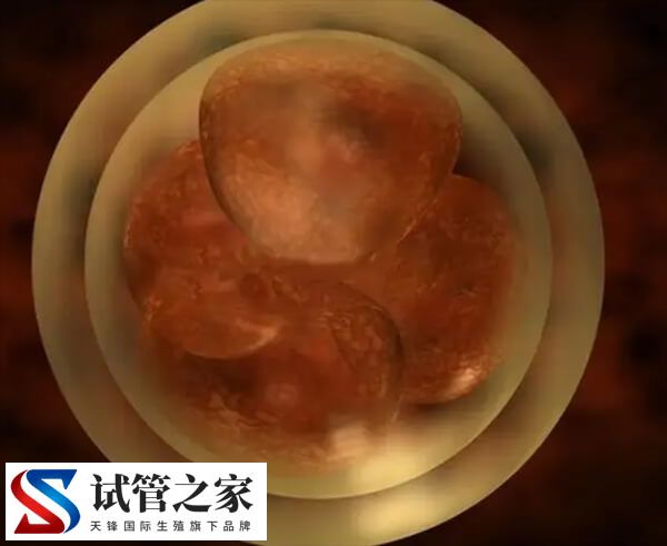 胚胎质量不好的原因和女性肥胖有关系吗？