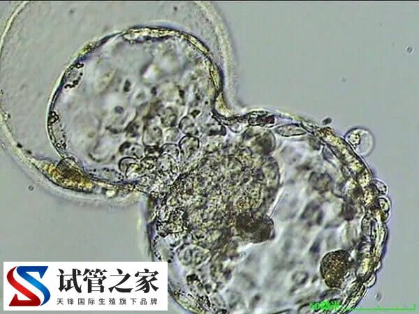 6bb囊胚容不容易生男孩