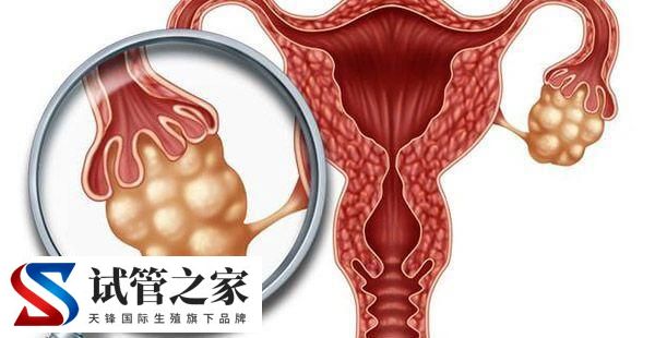 性激素六项检查报告单怎么看(图3) 性激素六项检查报告单怎么看(图3)