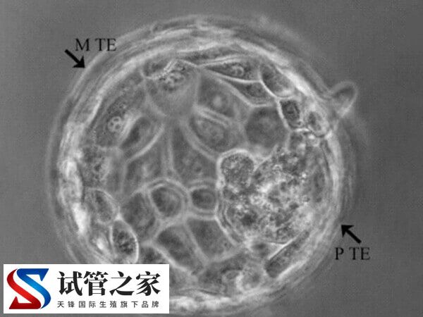 试管婴儿囊胚培养技术是什么(图2)