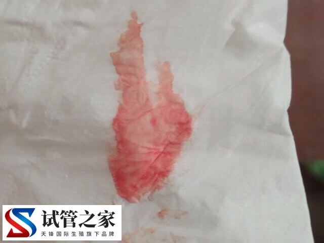 鲜胚移植13天成功有什么症状