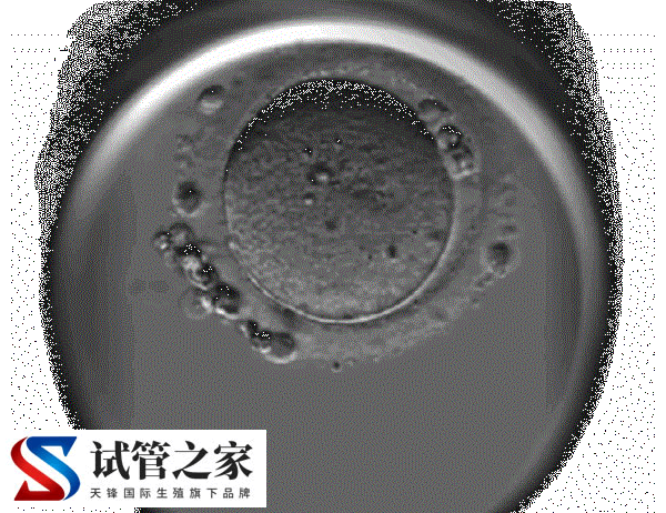 试管婴儿移植三级胚胎的成功率有40%吗？