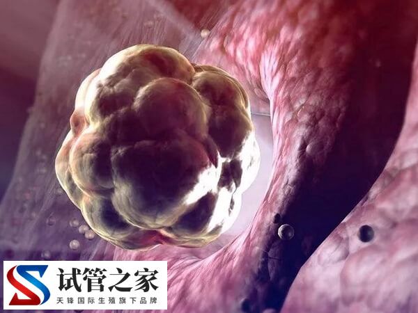 试管婴儿胚胎退化的原因是什么(图1) 试管婴儿胚胎退化的原因是什么(图1)