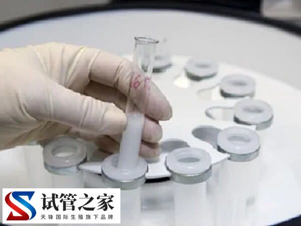 离心后镜检偶见几条活动精子拿去做试管婴儿能成功吗？(图1)