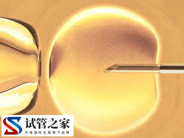 短方案促排后打hcg的作用是什么