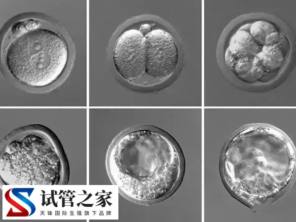 受精卵解冻失败的概率多高(图1)