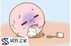 卵泡黄素化用中医怎么调理