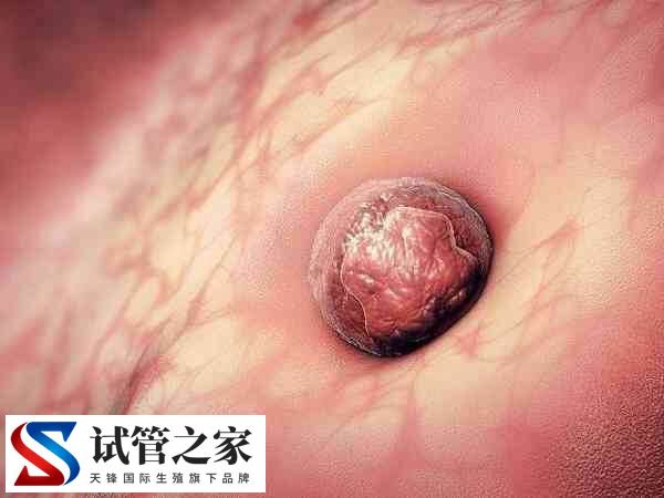 子宫内膜活跃对胚胎着床好不好(图1)