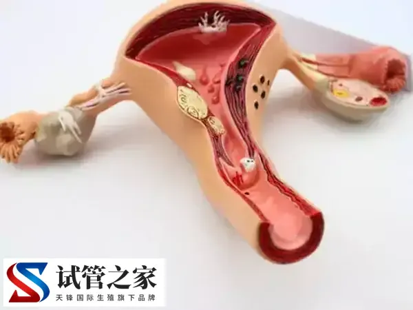始基子宫怎么治疗(图1)