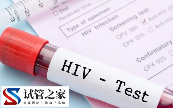 妇幼保健院接不接艾滋病的产妇(图2)