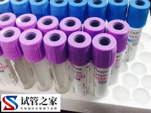 试管哪些检查一年后要重新查(图1) 试管哪些检查一年后要重新查(图1)
