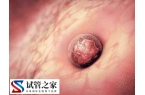 子宫内膜活跃对胚胎着床好不好